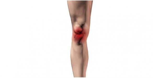 Illustration of leg with red area indicating knee pain